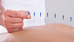 Untitled design 2021 06 02T114939.292 300x169 Can Acupuncture Help Motion Sickness?